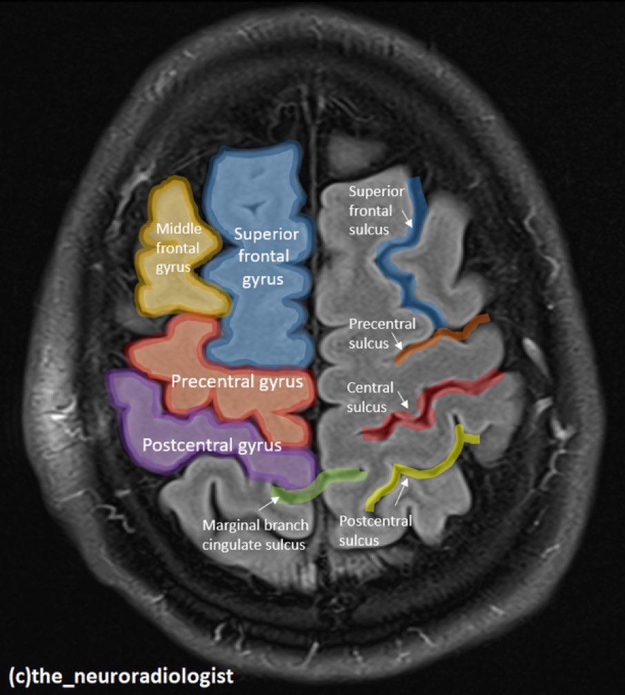 Brain Gyrus Labeled